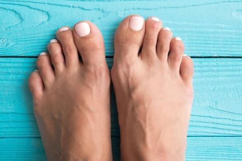 toe fungus remedy